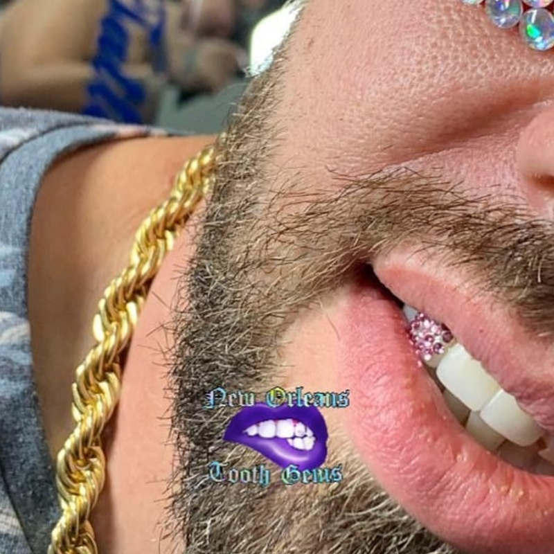 Home - Tooth Jewelry And Teeth Whitening in New Orleans