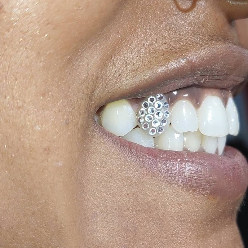 Tooth Jewelry Technician Training